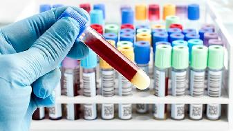 新冠疫情全球肆虐,群体免疫存争议,我国初步控制国外严重