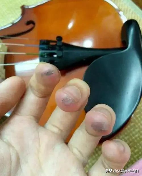 高考艺术生出路迷茫?2026就业更卷,别盲目学